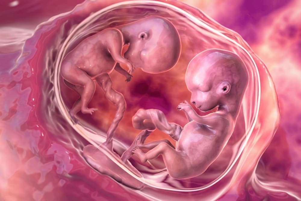 Fetus in fetu – co to jest? Przyczyny, objawy, diagnostyka, leczenie