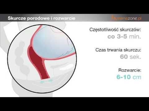 Rozwarcie szyjki macicy - video