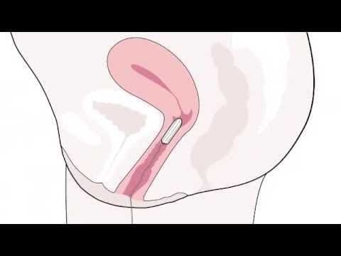Tampon: jak założyć tampon - video