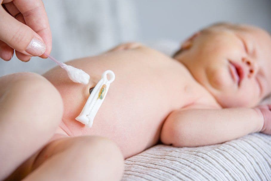Kikut pępowiny – czym jest, jak o niego dbać, kiedy odpada, co robić gdy krwawi?