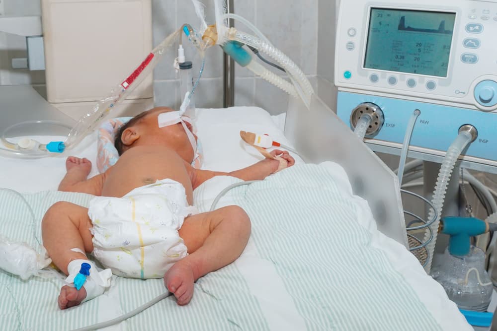 Zespół aspiracji smółki – przyczyny, objawy, sposoby leczenia