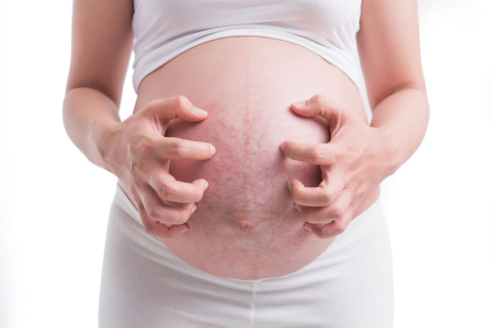 Dermatozy ciężarnych – przyczyny, rodzaje, jak leczyć